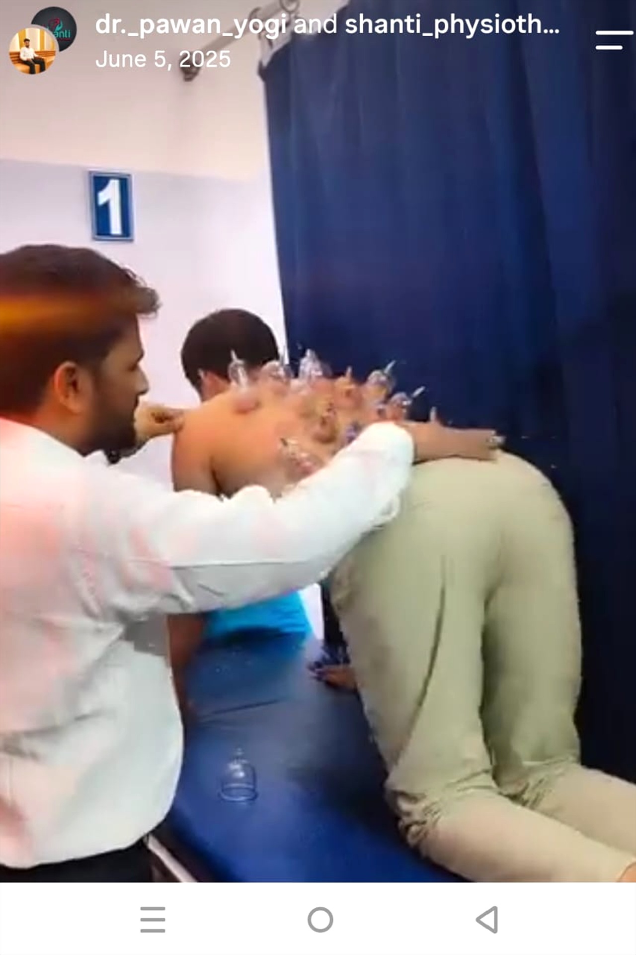 Cupping Therapy